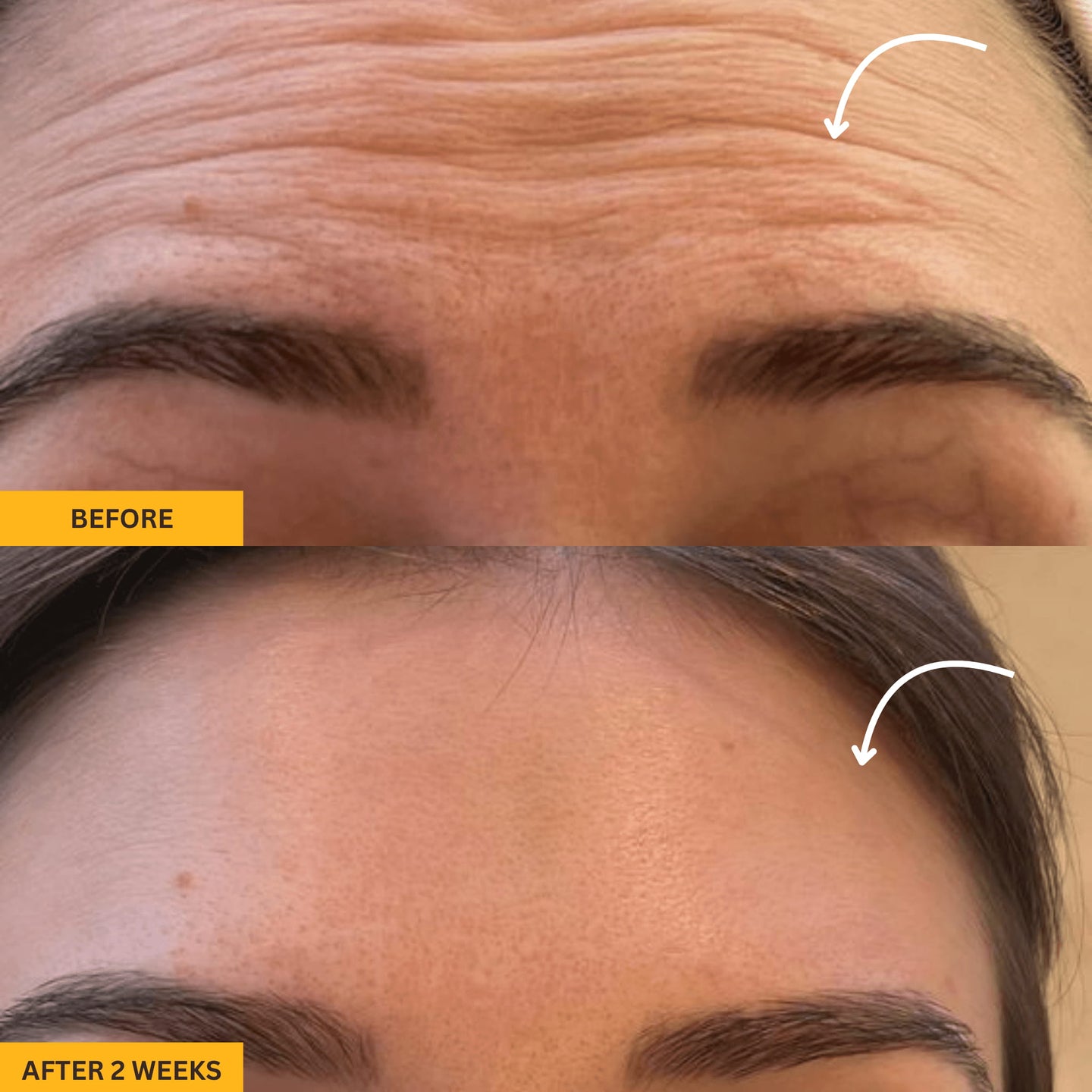 Lymphatic Contour Face Brush